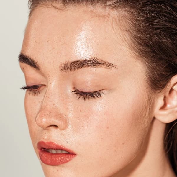 How Restylane VITAL Works