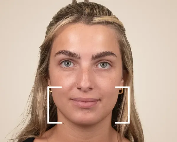 Masseter