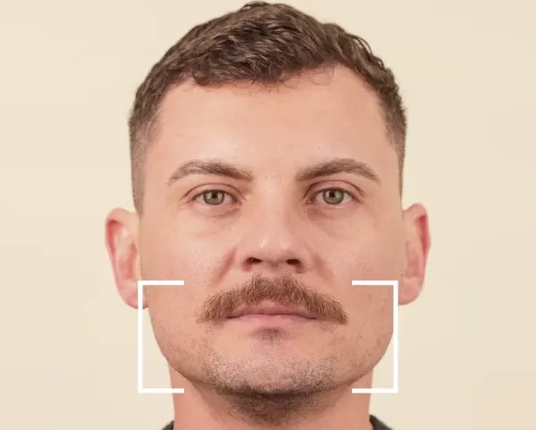 Masseter
