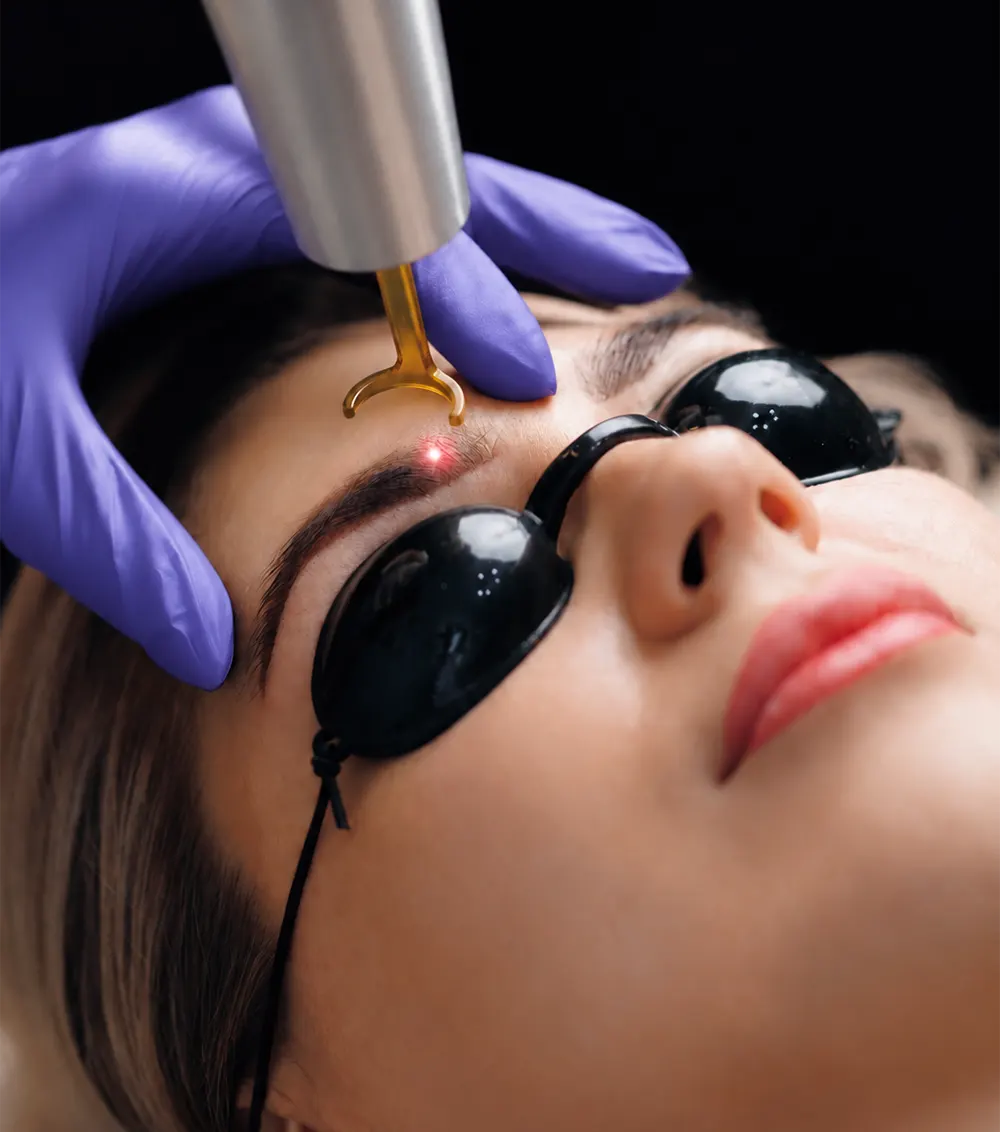 How Does Brow Tattoo Removal Work? How Does Brow Tattoo Removal Work?