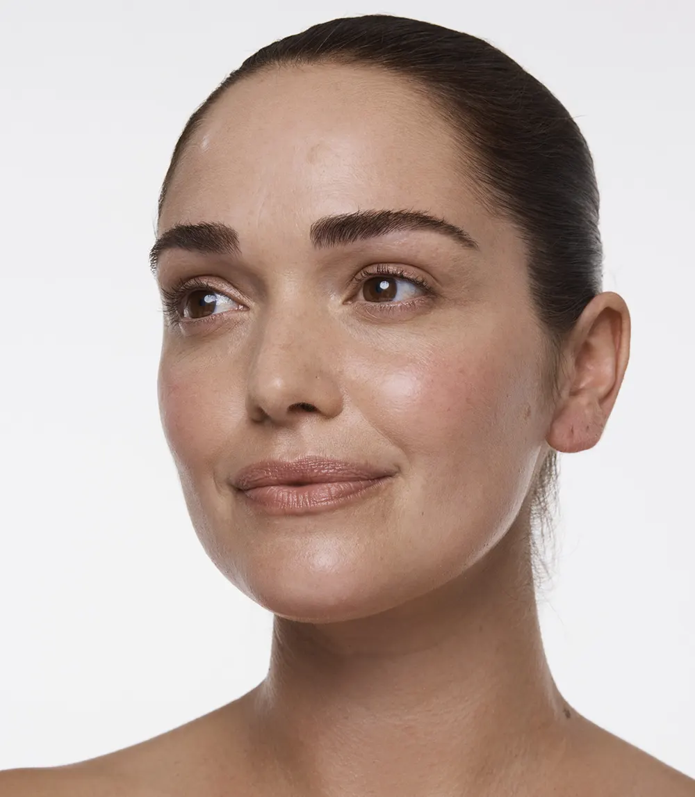 Microneedling +PDRN Microneedling +PDRN